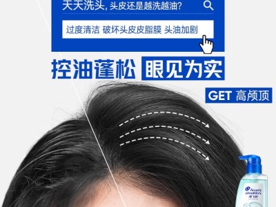海飞丝头皮护理洗发水控油蓬松女士持久留香670g去屑男士洗头膏图5